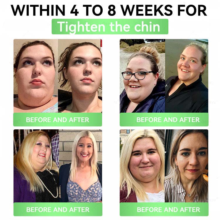 👩‍⚕️Alcuras™ Moringa × Berberine × AMPK 8-Benefit Slimming & Metabolic Nano Microneedle Patch 🇺🇸  Just once a day · Visible changes in 7 days  ✅ For obesity, loose skin, diabetes, sleep apnea, joint issues, and more