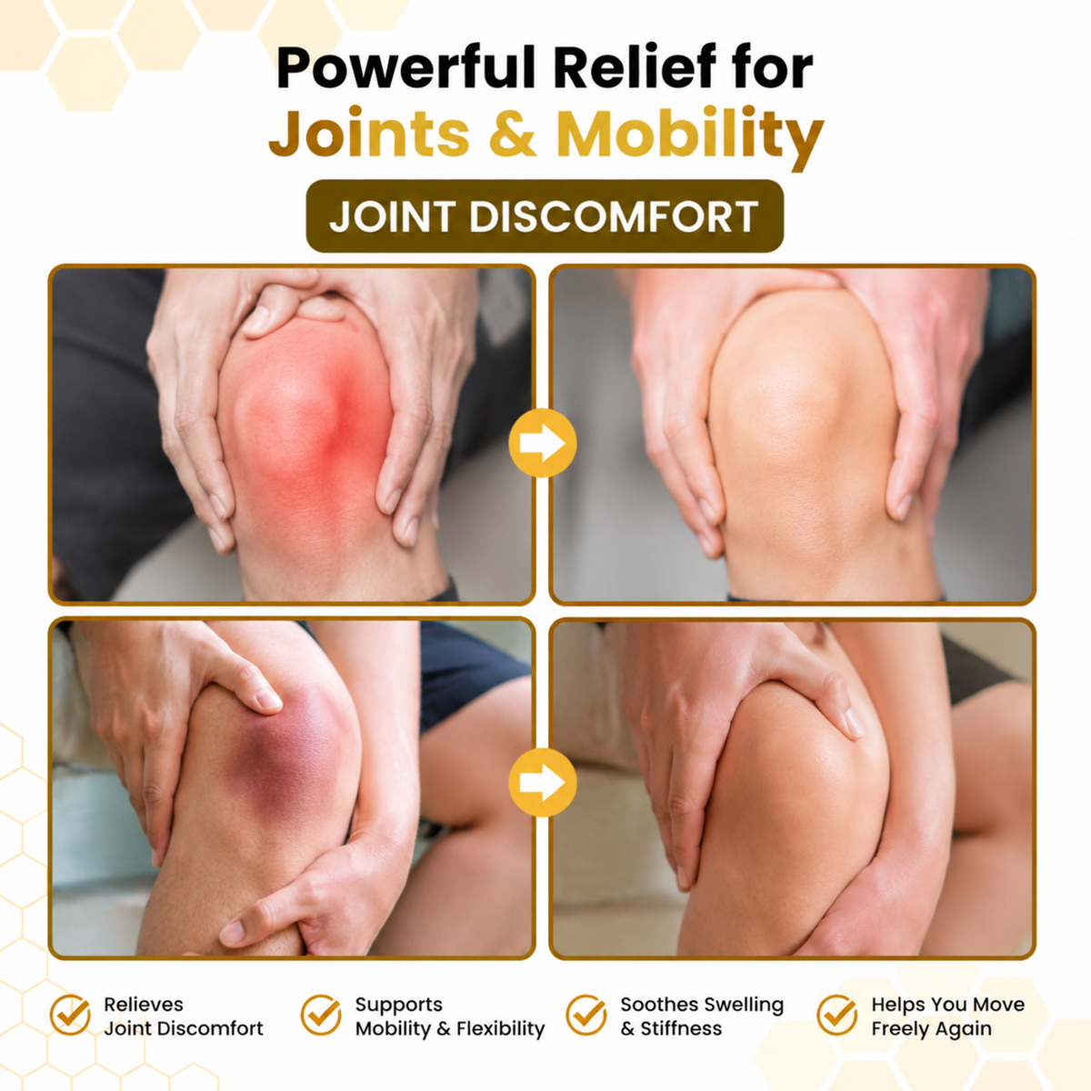 Alcuras® PsoriaSoothe Bee Venom Joint Comfort Cream（