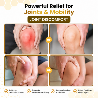 Alcuras® PsoriaSoothe Bee Venom Joint Comfort Cream（