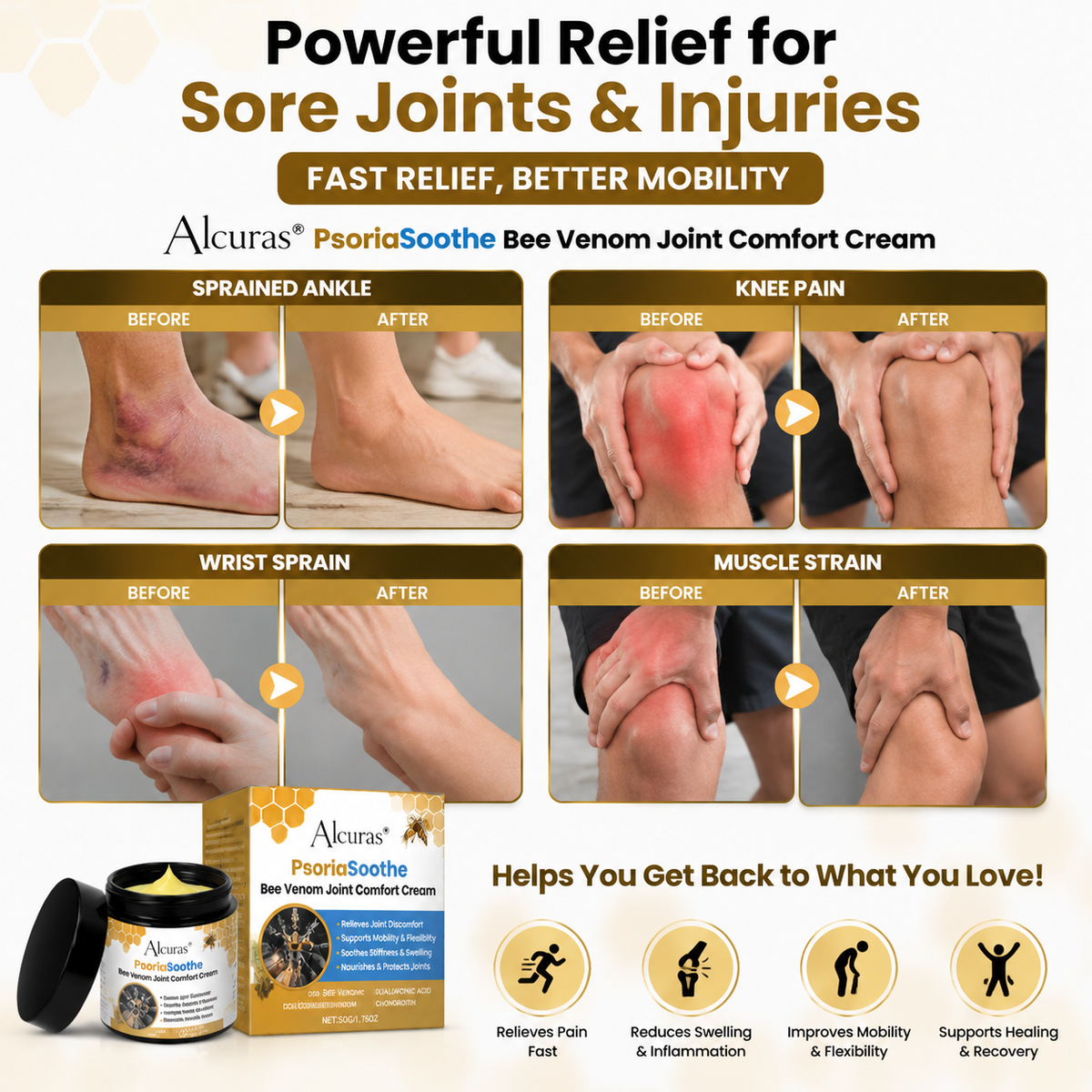 Alcuras® PsoriaSoothe Bee Venom Joint Comfort Cream（
