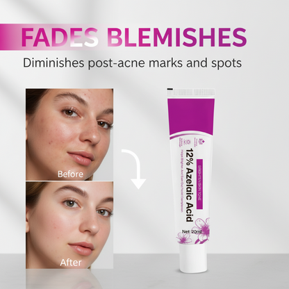 ⏰Black Friday Countdown! ⚡ 12% Azelaic Acid Acne Cream
